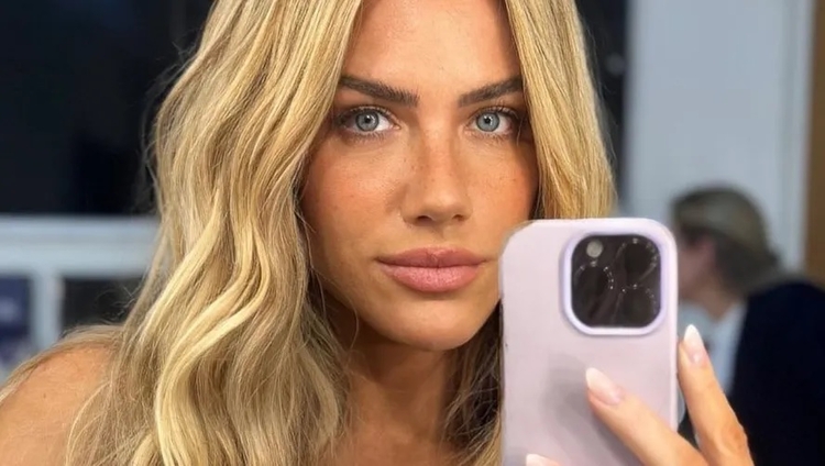 Giovanna Ewbank dá close no rosto após cirurgia no nariz e arranca elogios