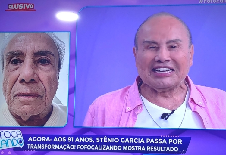 Stenio Garcia faz harmonização facial aos 91 anos e choca resultado