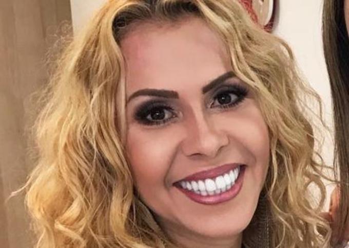 Joelma surge transformada e impressiona após procedimentos ...