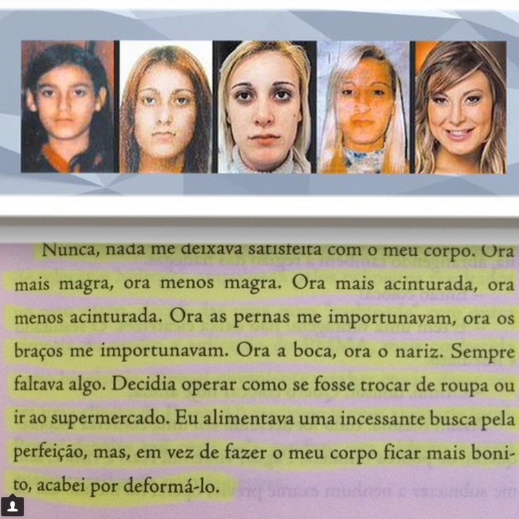 Antes e depois das cirurgias plásticas