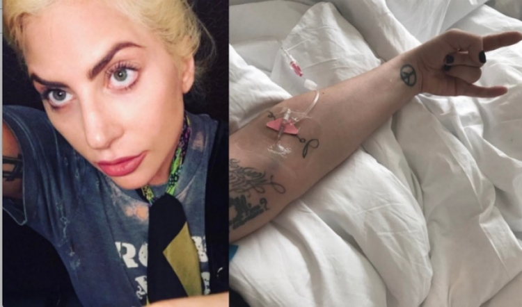 Trate Naturalmente A Fibromialgia Com Ch S A Doen A Que Tirou Lady Gaga Do Rock In Rio