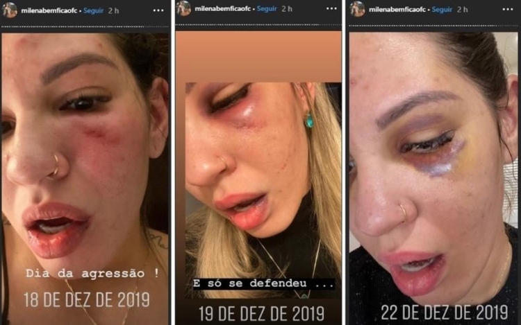 Foto: Reprodução Instagram - Milena Bemfica