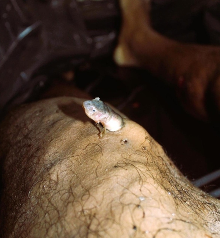 Foto de candiru saindo de cadáver retirado das águas do rio Negro - Foto: Gisleine Medrado