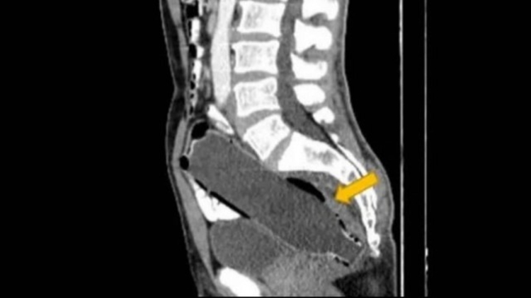 Foto: Reprodução / Clinical Case Reports