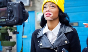 Quebrando tabus de beleza modelo com vitiligo se destaca em reality 