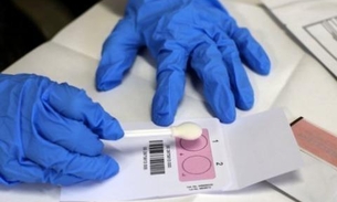 Suprema Corte americana decide que DNA humano não pode ser patenteado