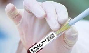 Rússia é acusada de usar hackers para tentar roubar pesquisa de vacina para Covid-19