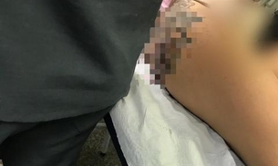 Bandidos atiram em mulher que não tinha celular durante tentativa de assalto em Manaus 