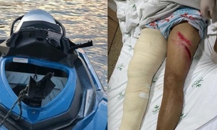 Josué Neto fraturou osso e sofreu lesões generalizadas em acidente com Jet Ski