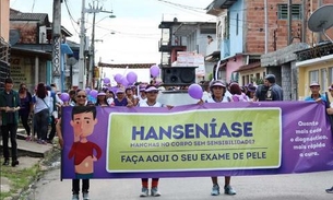 Caminhada em Manaus alerta para a importância do combate à hanseníase