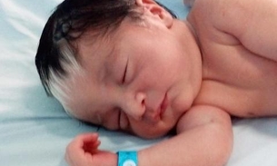 Bebê nasce com mecha branca no cabelo e encanta internautas 