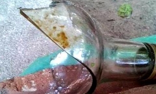 Com gargalo de garrafa, mulher desfigura rosto de marido em Manaus
