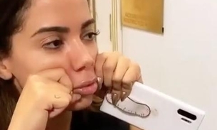 Anitta faz preenchimento labial para ficar igual a filtro do Instagram