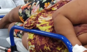 Grávida passa por procedimentos de emergência para não perder bebê em Manaus