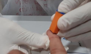 Dezembro Vermelho: Fundação Tropical realiza 323 testes rápidos de HIV em dois dias