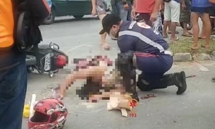 Homem tem dedos decepados em acidente gravíssimo com motocicleta em Manaus