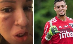 Acusado de agredir a mulher, goleiro Jean é liberado após audiência nos EUA