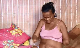 Mulher sem mãos e pernas tem pedido de benefício negado pelo INSS por não poder assinar papel