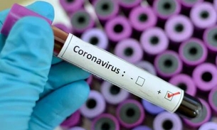 Pesquisadoras analisam epidemia de coronavírus em tempo real