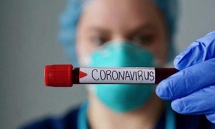 Hospital confirma nova morte por coronavírus e Brasil chega a 8 