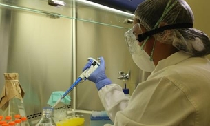 Amazonas adquire 60 mil testes rápidos para novo coronavírus 