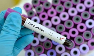 Mais de 700 testes de coronavírus foram realizados no Amazonas 