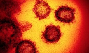 Pesquisadores descobrem anticorpos que podem combater coronavírus 