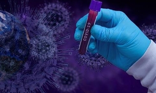 Coronavírus: mais de 8 milhões de pessoas infectadas no mundo