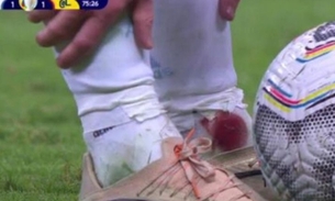 Imagem do tornozelo de Messi sangrando - Foto: Reprodução / Twitter