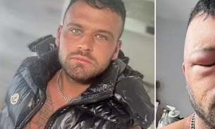 Homem teve reação alérgica a tinta de cabelo - Imagens: Reprodução/Tiktok