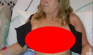 Silicone explode e mulher precisa reconstituir as mamas